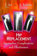 K3/NoviceDesno/hip_replacement_cover.png